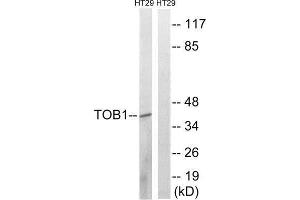 Western Blotting (WB) image for anti-Protein Tob1 (TOB1) (pSer164) antibody (ABIN1847817) (Protein Tob1 (TOB1) (pSer164) antibody)
