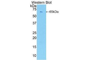 Western Blotting (WB) image for anti-Endothelial Cell-Specific Molecule 1 (ESM1) (AA 22-184) antibody (ABIN1858741) (ESM1 antibody  (AA 22-184))