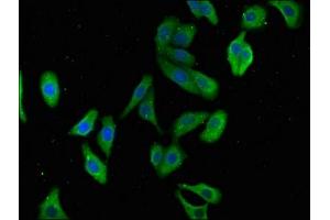 Immunofluorescence staining of HepG2 cells with ABIN7173782 at 1:100, counter-stained with DAPI. (TNFAIP8L2 antibody  (AA 1-184))
