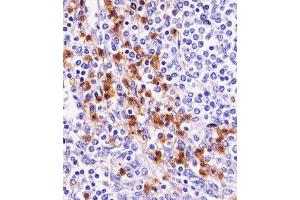 Immunohistochemistry (Paraffin-embedded Sections) (IHC (p)) image for anti-Integrin alpha M (ITGAM) (AA 253-282), (N-Term) antibody (ABIN654625)