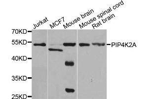 Western blot analysis of extracts of various cell lines, using PIP4K2A antibody (ABIN5975539) at 1/1000 dilution. (PIP4K2A antibody)