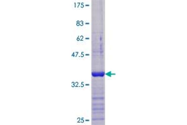 VDAC1 Protein (AA 156-276) (GST tag)