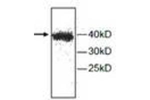 Image no. 1 for anti-Cathepsin H (CTSH) antibody (ABIN791523) (Cathepsin H antibody)