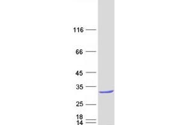 RAB28 Protein (Transcript Variant 1) (Myc-DYKDDDDK Tag)