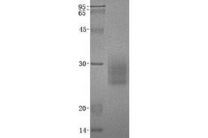 Validation with Western Blot (NCR3 Protein (Transcript Variant 2) (His tag))