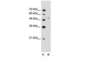 Image no. 2 for anti-Nicotinamide phosphoribosyltransferase (NAMPT) (C-Term) antibody (ABIN203416) (NAMPT antibody  (C-Term))