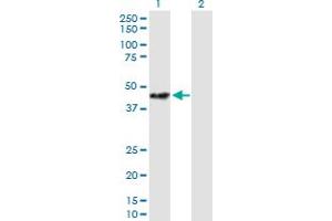 Western Blot analysis of STOML2 expression in transfected 293T cell line by STOML2 MaxPab polyclonal antibody. (STOML2 antibody  (AA 1-356))