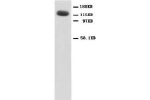NMDAR1 Polyclonal Antibody (NMDA 1 Receptor antibody  (N-Term))