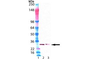 Western Blot analysis of : Lane 1: SeeBlueTMPlus2 MW Marker, Lane 2: HeLa cell lysate , Lane 3: Jurkat cell lysate . (Proteasome 20S Beta2 Subunit antibody)