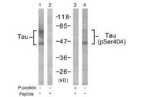 Image no. 1 for anti-Microtubule-Associated Protein tau (MAPT) (Ser404) antibody (ABIN197271) (MAPT antibody  (Ser404))