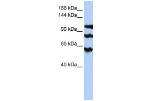 PPP1R13B antibody used at 1 ug/ml to detect target protein. (PPP1R13B antibody)