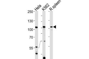 Western Blotting (WB) image for anti-Tuftelin Interacting Protein 11 (TFIP11) antibody (ABIN3001310) (TFIP11 antibody)