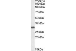 Western Blotting (WB) image for anti-Thioredoxin Domain Containing 5 (Endoplasmic Reticulum) (TXNDC5) (C-Term) antibody (ABIN2465650) (TXNDC5 antibody  (C-Term))