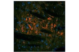 TH antibody used at a concentration of 10 ug/ml to detect substantia nigra and solitary tract in rodent brain (red). (TH antibody  (N-Term))