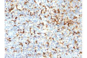 Immunohistochemistry (IHC) image for anti-Tyrosinase-Related Protein 1 (TYRP1) (AA 257-377) antibody (ABIN6940842)