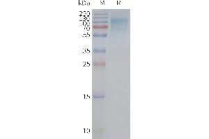 Human A12-Nanodisc, Flag Tag on SDS-PAGE (GLUT12 Protein)