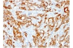 Immunohistochemistry (IHC) image for anti-beta-2-Microglobulin (B2M) antibody (ABIN6940416)