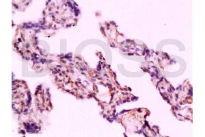 Immunohistochemistry (IHC) image for anti-Toll-Like Receptor 4 (TLR4) (AA 751-835) antibody (ABIN736491)