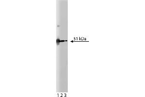 Western Blotting (WB) image for anti-PKA RIIalpha (AA 1-404) antibody (ABIN968784) (PKA RIIalpha (AA 1-404) antibody)