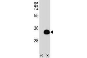 Western blot analysis of SIRT5 antibody and 293 cell lysate (2 ug/lane) either nontransfected (Lane 1) or transiently transfected (2) with the SIRT5 gene. (SIRT5 antibody  (AA 99-127))