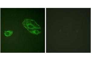 Immunofluorescence (IF) image for anti-Receptor Tyrosine-Protein Kinase ErbB-3 (ERBB3) (AA 1256-1305) antibody (ABIN2888848) (ERBB3 antibody  (AA 1256-1305))