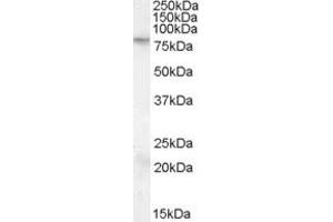 ABIN263156 (0. (FMR1 antibody  (Internal Region))