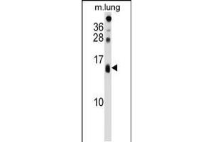 Western blot analysis in mouse lung tissue lysates (35ug/lane). (DEXI antibody  (C-Term))