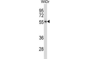 Western Blotting (WB) image for anti-Nuclear Receptor Subfamily 2, Group E, Member 3 (NR2E3) antibody (ABIN2997810) (NR2E3 antibody)