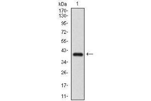 Western blot analysis using SMCP mAb against human SMCP (AA: 1-116) recombinant protein. (SMCP antibody  (AA 1-116))