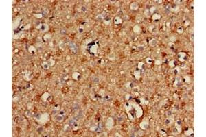 Immunohistochemistry of paraffin-embedded human brain tissue using ABIN7170654 at dilution of 1:100 (SPRY2 antibody  (AA 2-97))