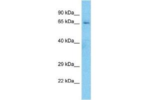 Host:  Rabbit  Target Name:  ES8L1  Sample Type:  MDA-MB-435s Whole Cell lysates  Antibody Dilution:  1. (EPS8-Like 1 antibody  (C-Term))