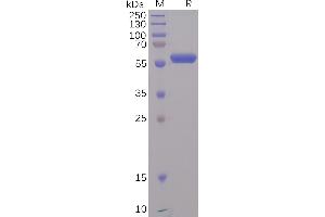 SDS-PAGE (SDS) image for SARS-CoV-2 Spike (RBD) protein (mFc Tag) (ABIN6961175)