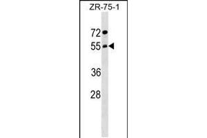 Western blot analysis in ZR-75-1 cell line lysates (35ug/lane). (ARCN1 antibody  (AA 296-324))