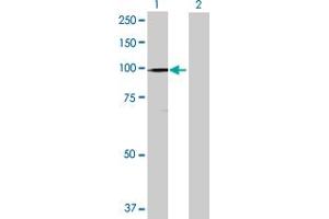 Western Blotting (WB) image for HMGCR 293T Cell Transient Overexpression Lysate(Denatured) (ABIN1332160)