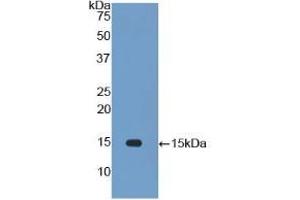 Detection of Recombinant IL34, Rat using Polyclonal Antibody to Interleukin 34 (IL34) (IL-34 antibody  (AA 21-109))