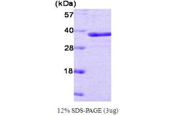 PTPN1 Protein