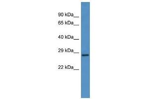 Western Blot showing CEACAM7 antibody used at a concentration of 1-2 ug/ml to detect its target protein. (CEACAM7 antibody  (N-Term))