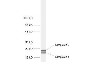 dilution: 1 : 1000, sample: rat brain homogenate (Complexin 1, 2 (C-Term) antibody)