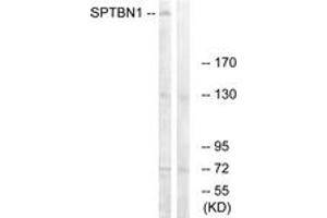 Western Blotting (WB) image for anti-Spectrin Beta, Non-Erythrocytic 1 (SPTBN1) (AA 651-700) antibody (ABIN2890653) (SPTBN1 antibody  (AA 651-700))