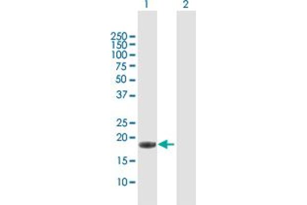 IL17C antibody  (AA 1-197)