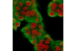 Immunofluorescence Analysis of MeOH-fixed Human MCF-7 cells labeling CK with Multi-Cytokeratin Recombinant Rabbit Monoclonal Antibody (KRT/1877R)followed by Goat anti-Mouse IgG-CF488 (Green). (Recombinant Cytokeratin, Multi (Epithelial Marker) antibody)