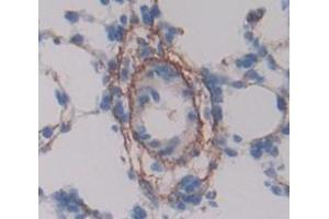 IHC-P analysis of lung tissue, with DAB staining. (MCAM antibody  (AA 323-560))