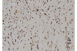 ABIN6273014 at 1/100 staining Rat heart tissue by IHC-P. (RNH1 antibody  (Internal Region))