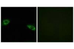 Immunofluorescence analysis of HuvEc cells, using RPS4Y1 antibody. (RPS4Y1 antibody  (C-Term))