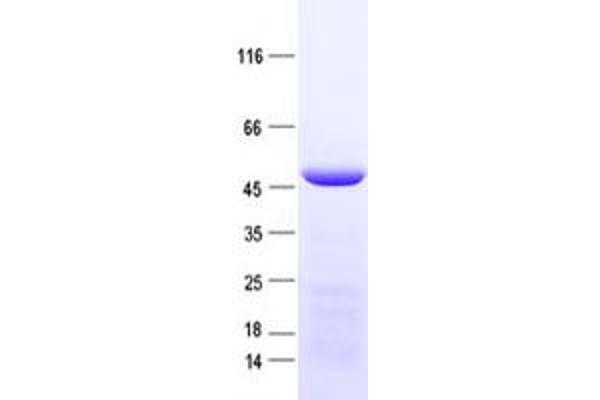 IDH3G Protein (His tag)