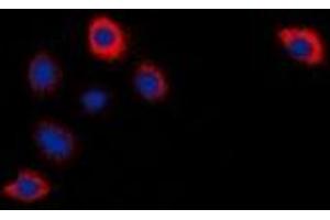 Immunofluorescent analysis of Cytochrome P450 2W1 staining in Hela cells. (CYP2W1 antibody)