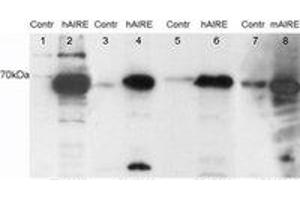 Image no. 1 for anti-Autoimmune Regulator (AIRE) (C-Term) antibody (ABIN374235) (AIRE antibody  (C-Term))