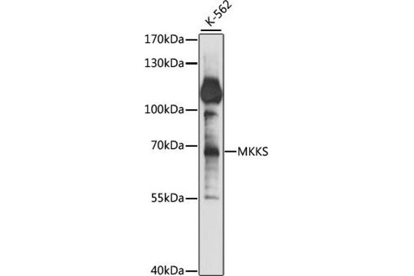 MKKS antibody  (AA 221-570)