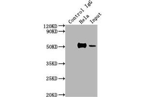 Western Blotting (WB) image for anti-Forkhead Box A1 (FOXA1) antibody (ABIN7127498)