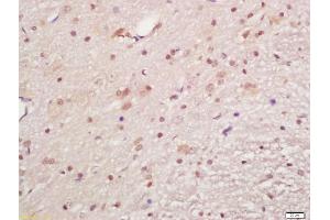 Formalin-fixed and paraffin embedded rat brain labeled with Anti-phospho-MAPKAPK5(Ser93)Polyclonal Antibody, Unconjugated (ABIN710561) at 1:200, followed by conjugation to the secondary antibody and DAB staining (MAPKAP Kinase 5 antibody  (pSer93))
